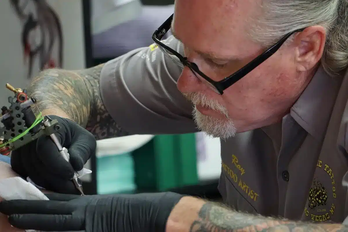 Braccia fasciate dopo seduta di rimozione tatuaggi